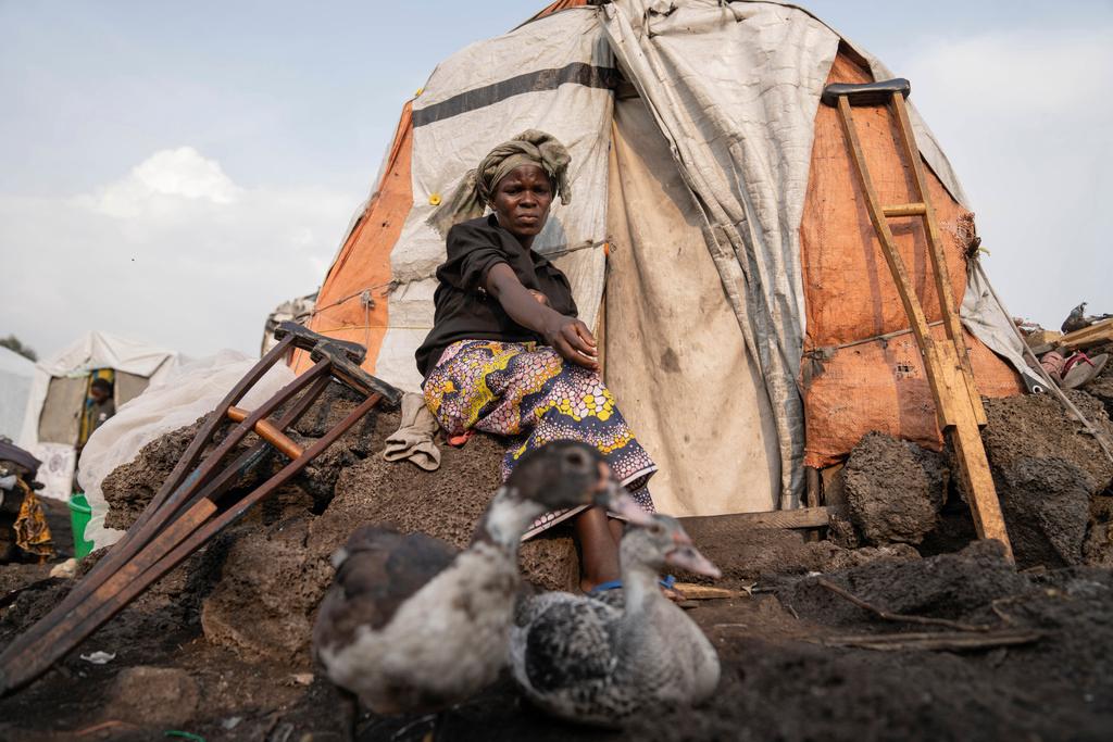 Sarah Bagheni, in the Bulengo refugee camp in Goma, Congo, suspects she may be infected with Mpox 