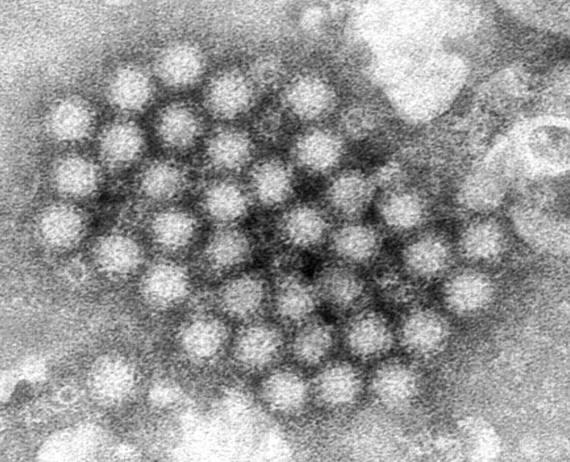 Cluster of norovirus virions